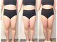 イストアールエム(HISTOIRE.M)の写真/リバウンドしない身体へ。【筋膜リリース】であなたの理想のボディへ◎