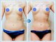 エムエムエム 表参道Luxeサロン(M.M.M)の写真/【表参道駅２分】バストが小さくウエストもメリハリがない…そんなお悩みに！M.M.Mなら女性らしい魅力UP◎