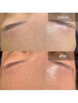 ナウ(now)/【陶肌トリートメント】