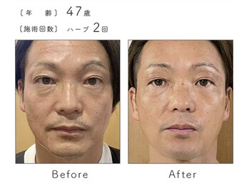 シックスティーエイトフェスター(68FESTAR★)/あれ?なにかした?と聞かれる★