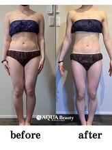 ビーエスアクアビューティー/全身ケア　BSメソッド