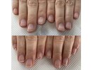 最強のネイルケアでお悩み解消！