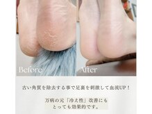 シュシュ(Chou chou)の雰囲気（ほっといていませんか？ガサガサかかとプロに任せてツルツルに◎）