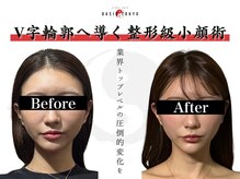 オアシス トウキョウ 心斎橋(OASIS TOKYO)