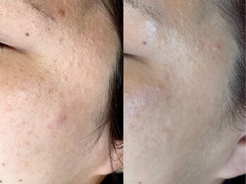 グラースア(grace a)/プラズマニア