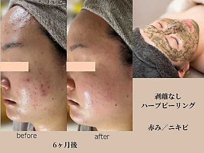 ソラ(Sora)｜ホットペッパービューティー