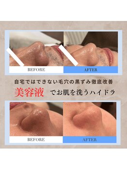 フルールスレーヌ(Fleur Sereine)/美容液で洗う本気の毛穴洗浄☆