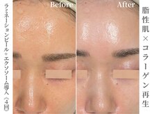 ゼアー(THERE FY.)/糖化で黄色くくすんだ肌も蘇る