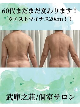 エデン(Eden)/60代　サイズダウン★痩身