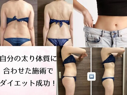 アール シュシュ(R.chouchou)の写真