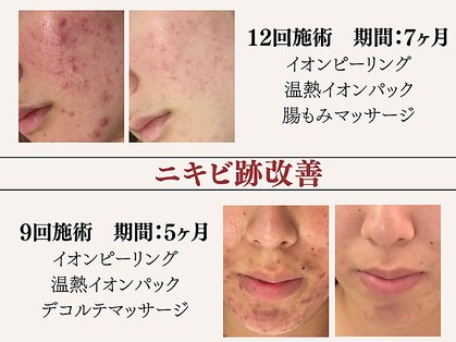 アクール(Accueil)の写真