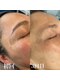 ボーホーアフロ(BOHO AFRO)の写真/秋の美肌ケア★産毛も古い確実もすっきりOFF！WAX&光フォトで素肌から輝くツヤ肌◎