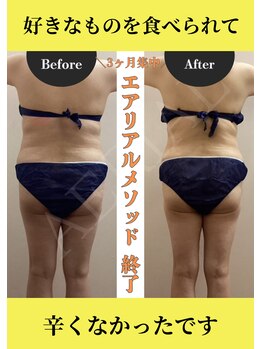 エアリアル 中津店/ダイエットモニター様