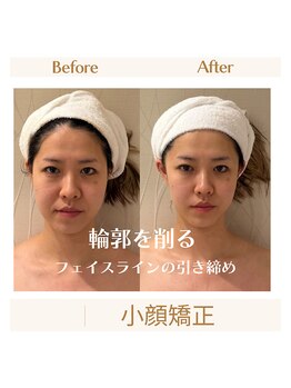 スカーレット 北参道(Scarlett)/Scarlett式小顔矯正