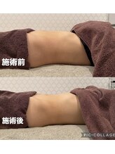 シャルム(CHARME)/赤岩式腸けずり