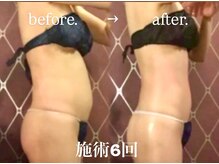 デアルーチェ(DEA LUCE)の雰囲気（痩身/ハイパーナイフ/ダイエット/お腹引き締め/筋膜リリース）