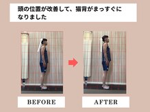 富雄みなみ整骨院/施術後のビフォーアフター