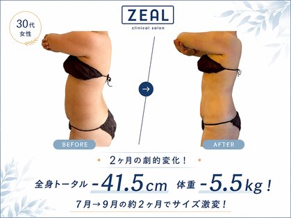 ジール 心斎橋(ZEAL)の写真