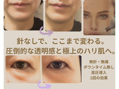 エステサロン プラスエー(+A)の写真