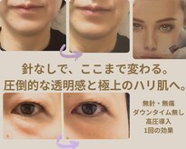 エステサロン プラスエー(+A)