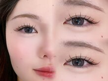 フラットラッシュ