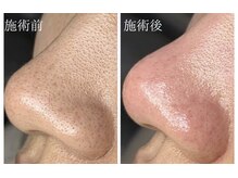 ジェリー(JERRY)/