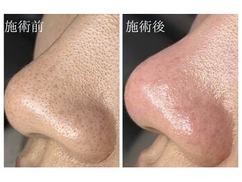 ジェリー(JERRY)/