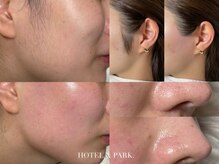 ホテルアンドパーク(HOTEL&PARK.)