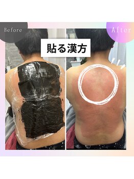 レチカ(Rechica)/心斎橋初！漢方温活湿布