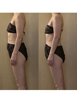 ココア(CoCoa)/活性リンパ洗浄