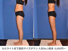 アンシャンテ 神戸元町店(Enchante)/痩身ダイエット　神戸元町三ノ宮