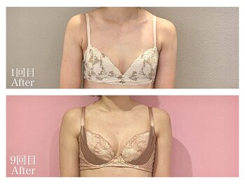 ククナ(KUKUNA)/*バストアップマッサージ*