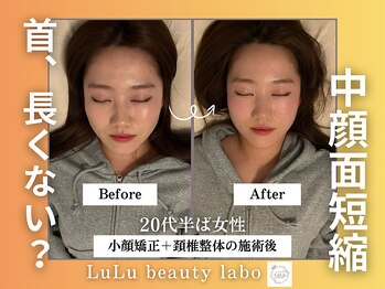 ルルラボ(LuLu beauty labo)/顔ちっさい!!
