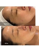 マインエム(mine.m)/ワックス×肌管理の最強コンボ