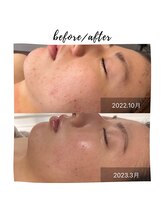 ビューティリュクス(beauty luxe)/むくみ、小顔解消&たまご肌に！