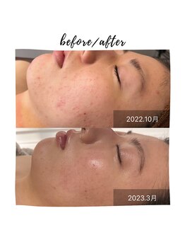 ビューティリュクス(beauty luxe)/むくみ、小顔解消&たまご肌に！