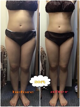 ミマインズ 倉敷本店(Me Mines)/before → after (4ヶ月後)