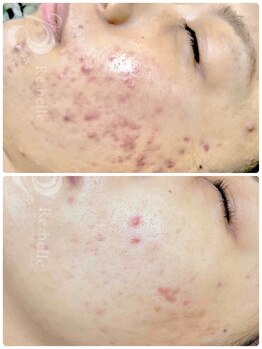 サロン バイオビオ(SALON BioBio)/