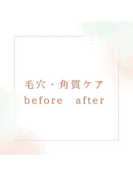 オレンジ(Orange)/