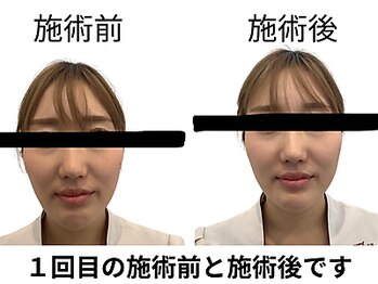 田端整体院/小顔整体/小顔矯正/伊勢崎/