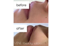 ウェヌ(VENE)