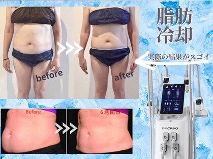 美ネージュの写真