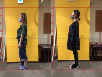 キラリ(KIRARI)/姿勢改善