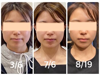 クリーム 京都店(Cream)/