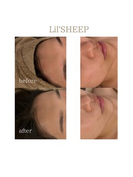 リルシープ(LIL'SHEEP)/陶肌トリートメント