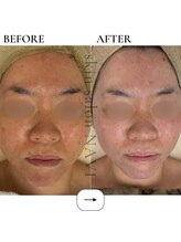 ナビ(NAVI)/老化に特化！／エイジングケア