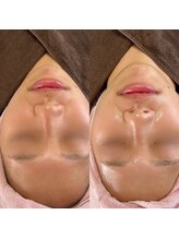 ルチルス(Rutiles)/20代/憧れのノーファンデ肌へ