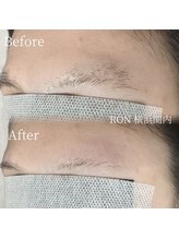 サロンロン 横浜関内(SALON RON)/眉毛/美容電気脱毛