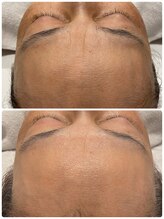 カイト(Kaito)/ビフォーアフター