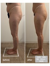 エムプラス(Mplus.)/骨盤底筋トレーニングチェア♪